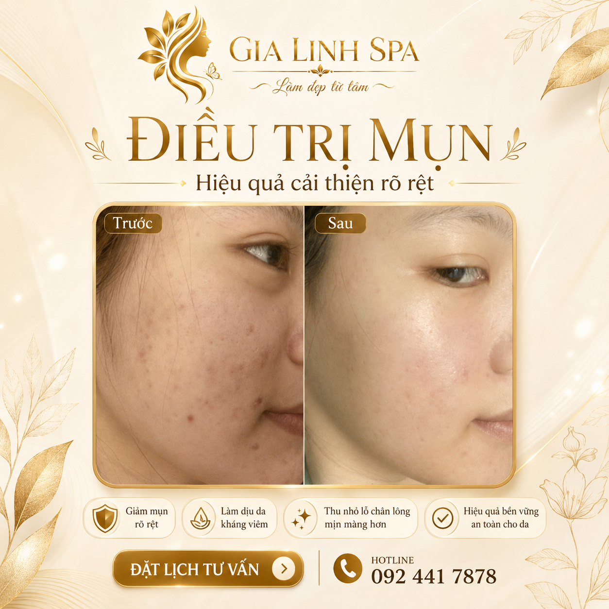 TẠI SAO CHỌN CHÚNG TÔI